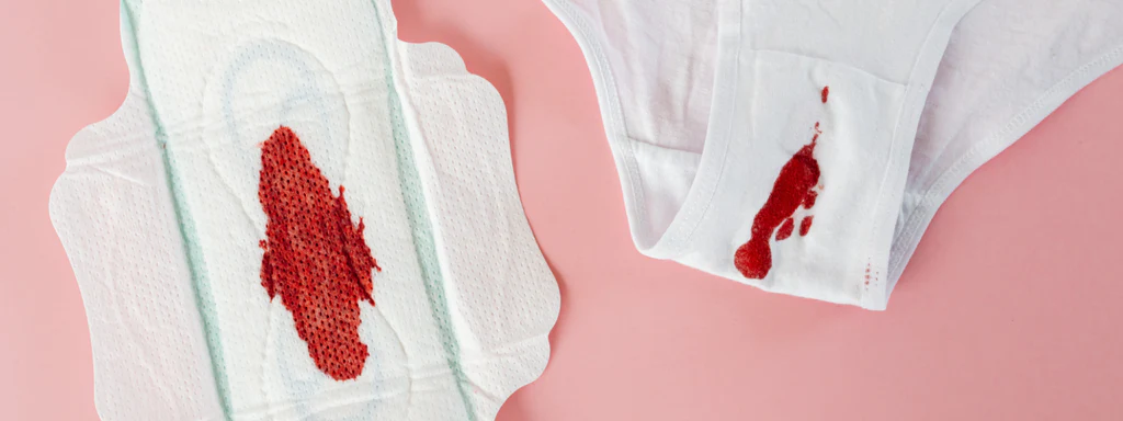 Eine Draufsicht vor rosa Hintergrund, die links eine weiße Damenbinde und rechts einen Teil einer weißen Unterhose zeigt. Auf beiden Gegenständen sind rote Flecken von Periodenblut zu sehen. Das Bild dient der enttabuisierten Darstellung der Menstruation und der Aufklärung über unterschiedliche Blutungsstärken im weiblichen Zyklus.