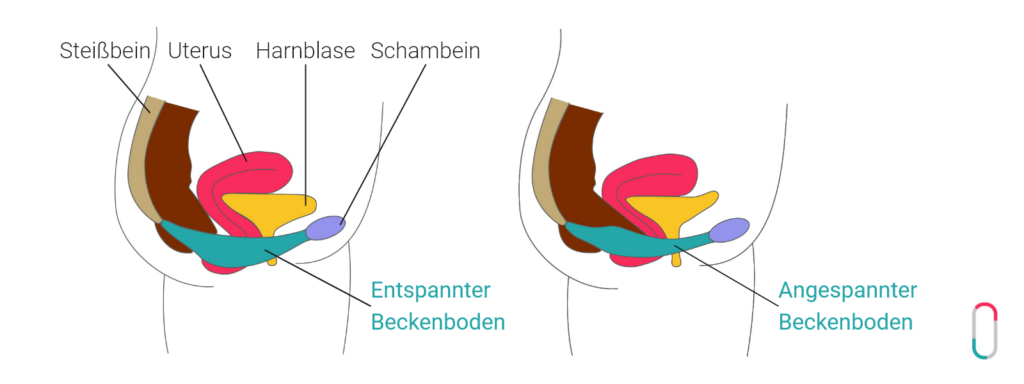 Eine anatomische Querschnitts-Illustration des weiblichen Beckens im Vergleich. Links wird ein „Entspannter Beckenboden“ gezeigt, rechts ein „Angespannter Beckenboden“. Die Grafik benennt zudem Steißbein, Uterus, Harnblase und Schambein. Sie verdeutlicht visuell, wie sich die Muskulatur (türkis markiert) hebt und festigt, was für das Verständnis der Lage des trackle Sensors wichtig ist.