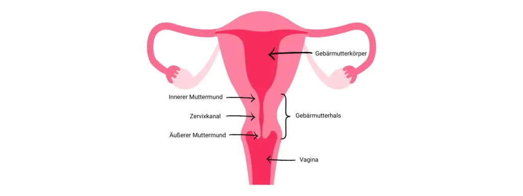 trackle und Endometriose